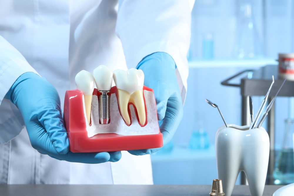 What to Expect During Your First Dental Implant Consultation