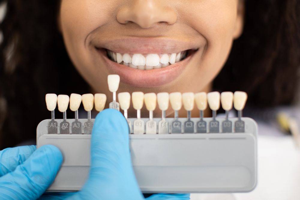 When Should You Consider Getting Dental Implants in Escanaba?